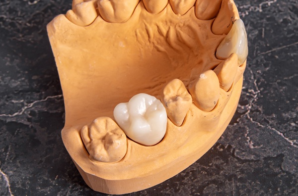 Reasons Your Dental Crown May Hurt