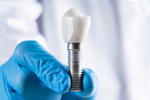 How A Surgical Dental Implant Fuses With  Jawbone