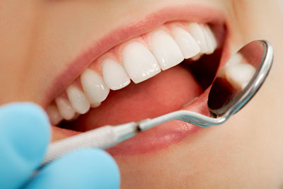 Visit Us For Dental Restorations And Dental Fillings In San Clemente