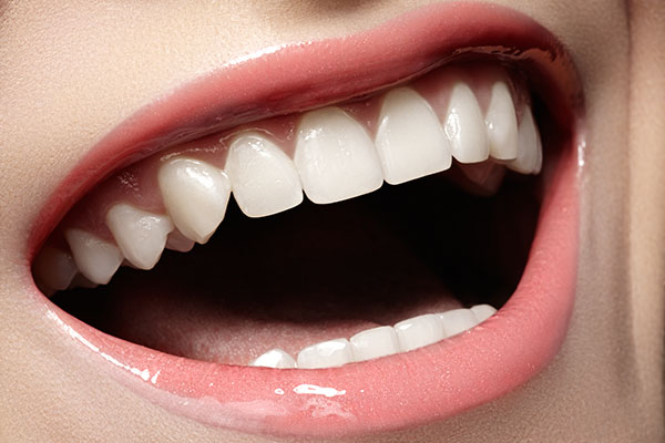 Ways Dental Sealants Help Keep Teeth Cavity Free