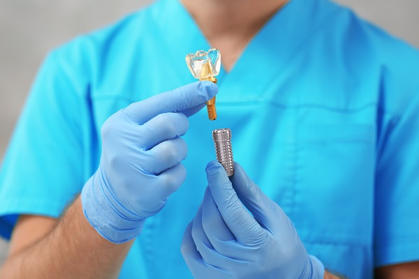Choosing The Right Implant Dentist