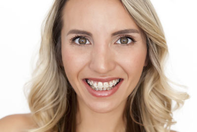 Visit A Clear Braces Dentist For Help With Your New Years’ Resolution